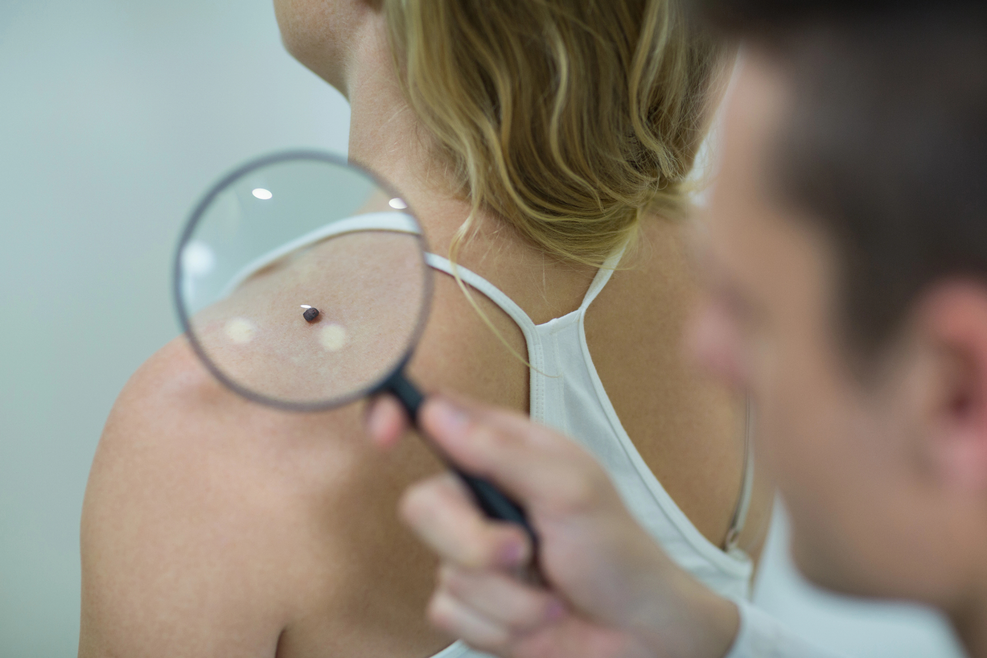 Danes dermatologija uspešno deluje v boju proti kožnemu raku